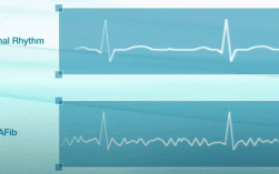 GE进口动态心电图有何独特优势？