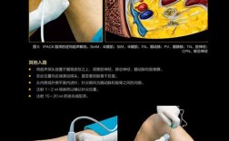 RBF神经系统修复技术效果如何？