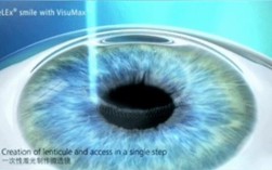 外层剥离技术elo，原理是什么？