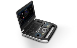 超声设备型号有哪些品牌