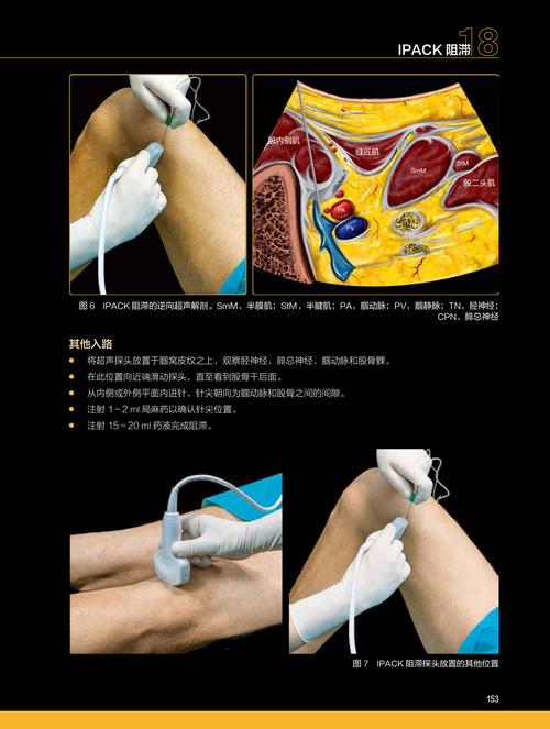 RBF神经系统修复技术效果如何？-图1