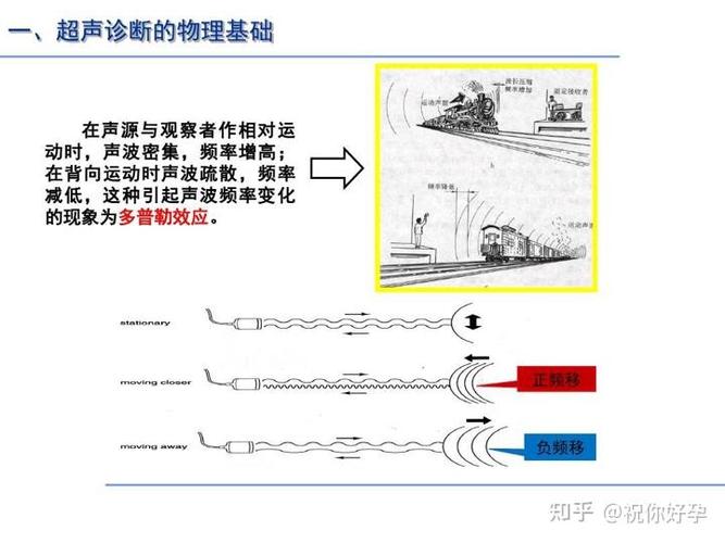 高频超声如何实现清晰成像？-图1