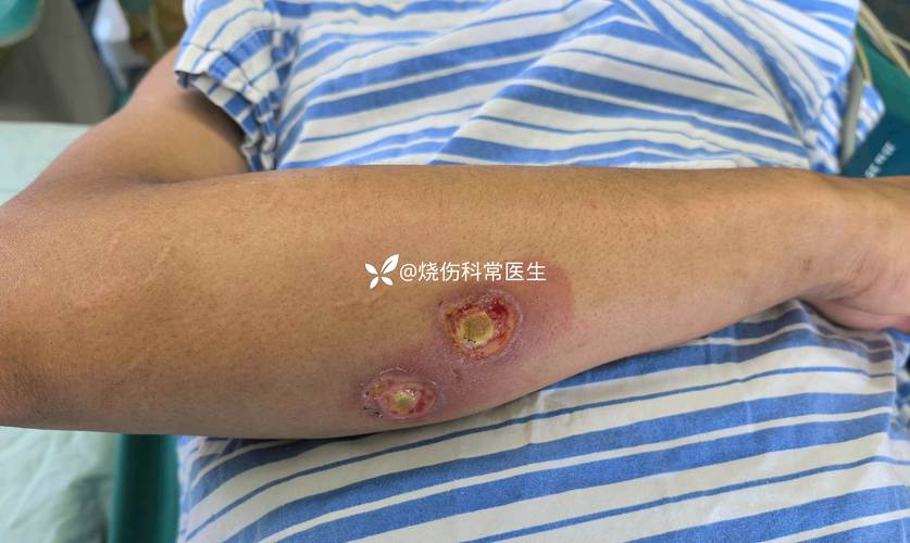 cmp后清洗技术进展-图2