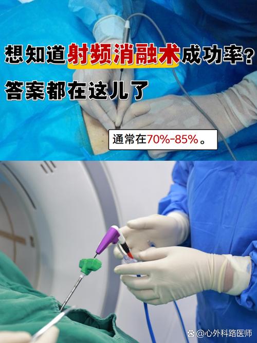 射频技术如何革新医疗领域应用？-图2