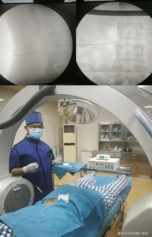 射频技术如何革新医疗领域应用？-图3