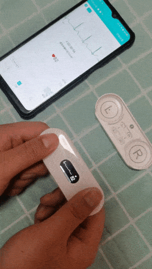 24小时动态心电图品牌选哪个好？-图2