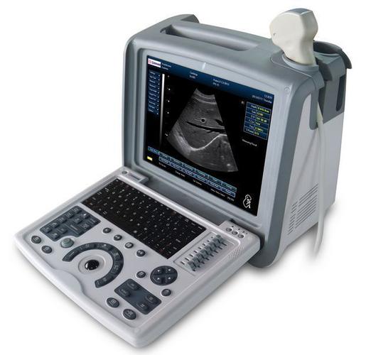 超声设备型号有哪些品牌-图3