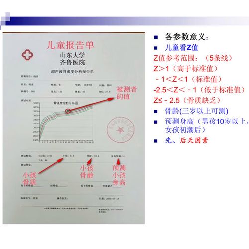 超声骨密度品牌哪个最靠谱?-图2 超声骨密度品牌哪个最靠谱?-图2