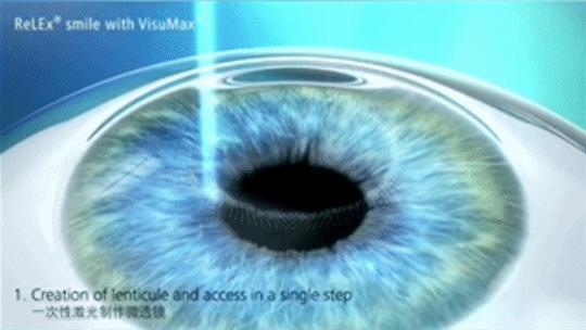 外层剥离技术elo,原理是什么?-图1 外层剥离技术elo,原理是什么?-图1