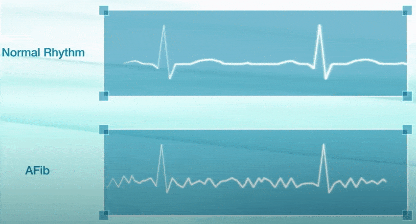 GE进口动态心电图有何独特优势?-图1 GE进口动态心电图有何独特优势?-图1