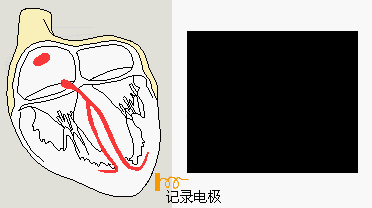 GE进口动态心电图有何独特优势?-图3 GE进口动态心电图有何独特优势?-图3