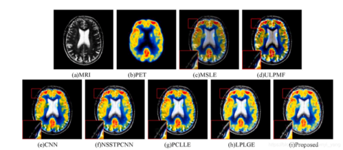 DSP图像处理技术有哪些核心优势？-图2