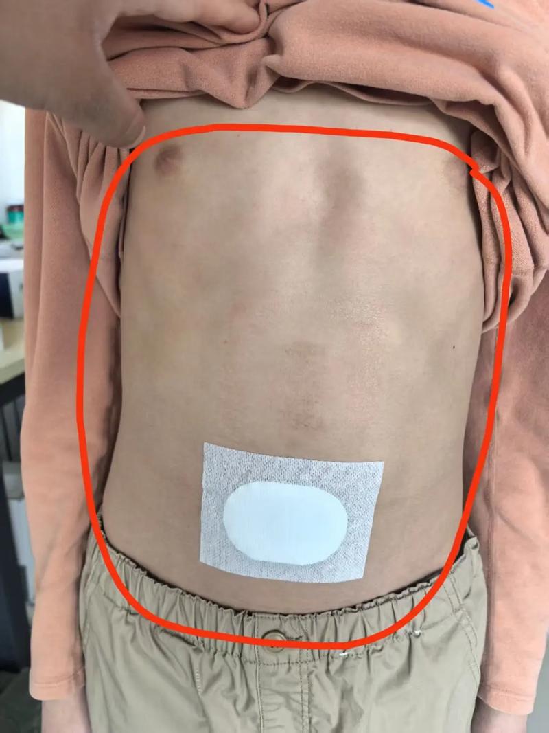 贴附技术目前业界水平如何?-图1 贴附技术目前业界水平如何?-图1