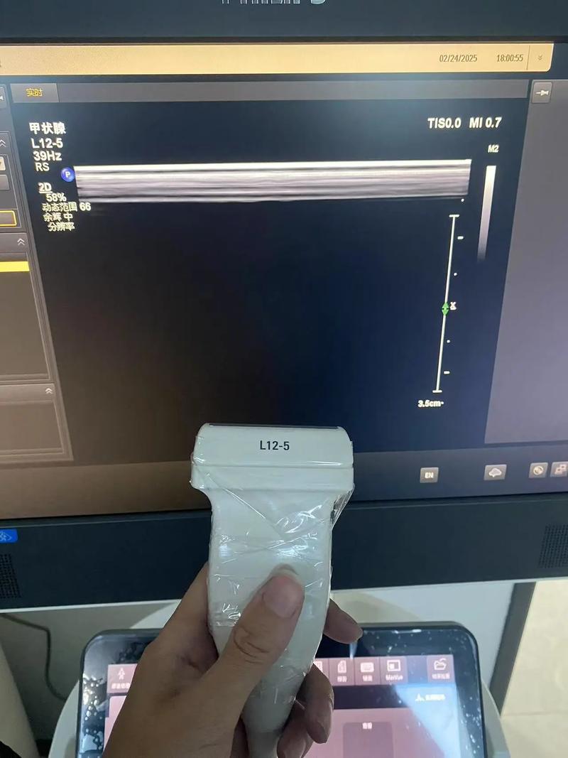 超声波探头如何拆解维修？-图1