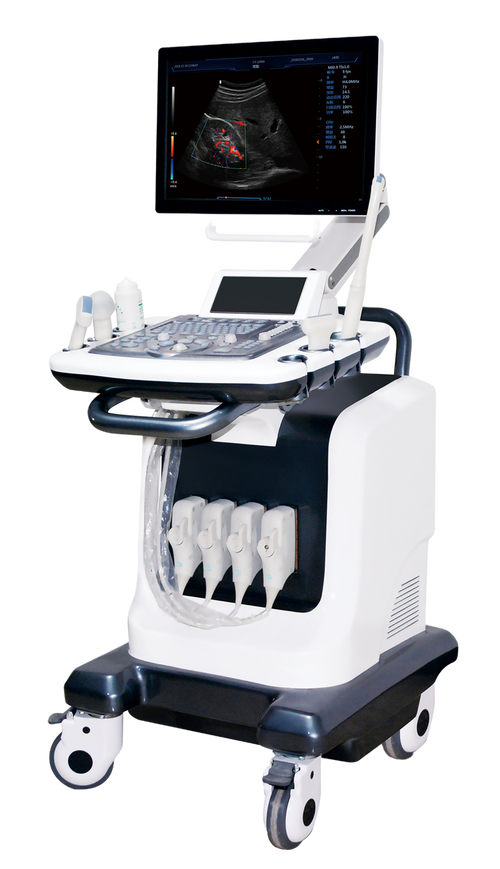 彩超机品牌价格差异大吗？-图2