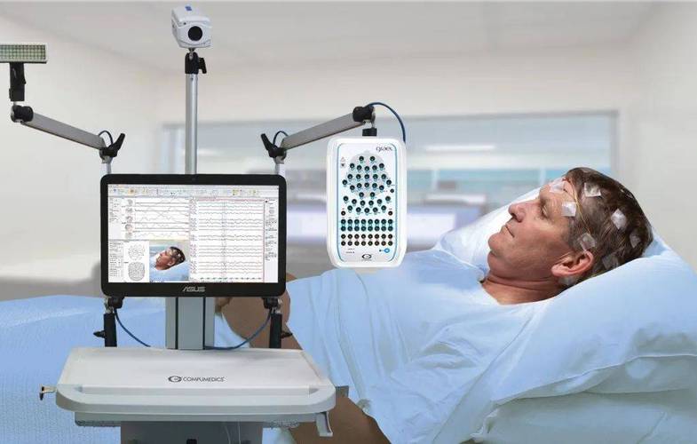 多导睡眠监测仪品牌有哪些？-图2