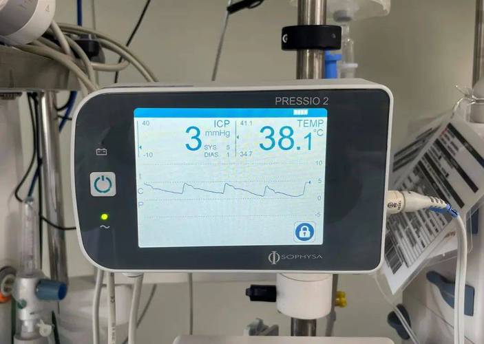 进口颅内压监测仪品牌有哪些？-图3