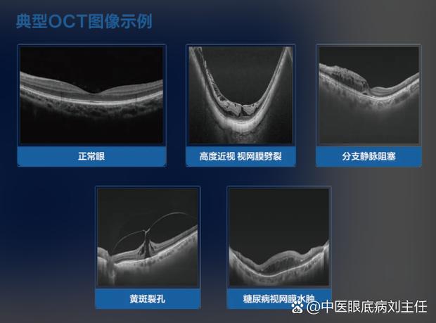 lcos投影技术缺陷-图2