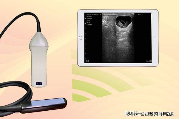 医用便携式B超机，哪些品牌值得选？-图3