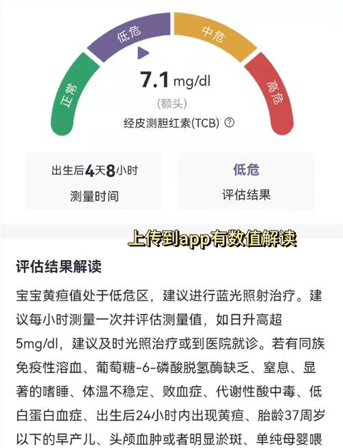 新生儿黄疸检测仪品牌怎么选？-图1