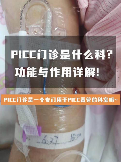 Picco技术有哪些显著优点？-图1