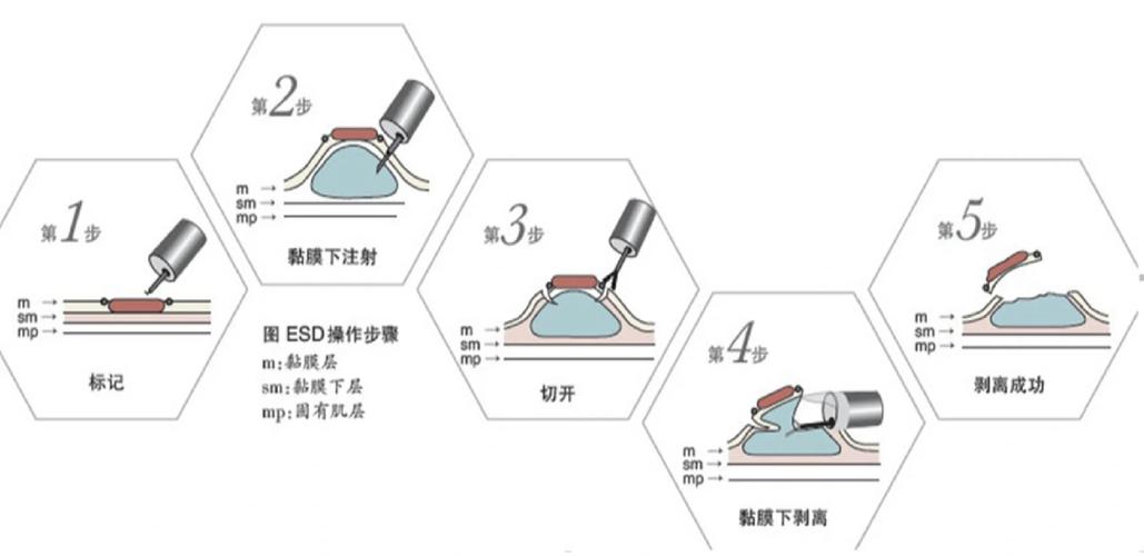 Buddy技术如何有效介入？-图3