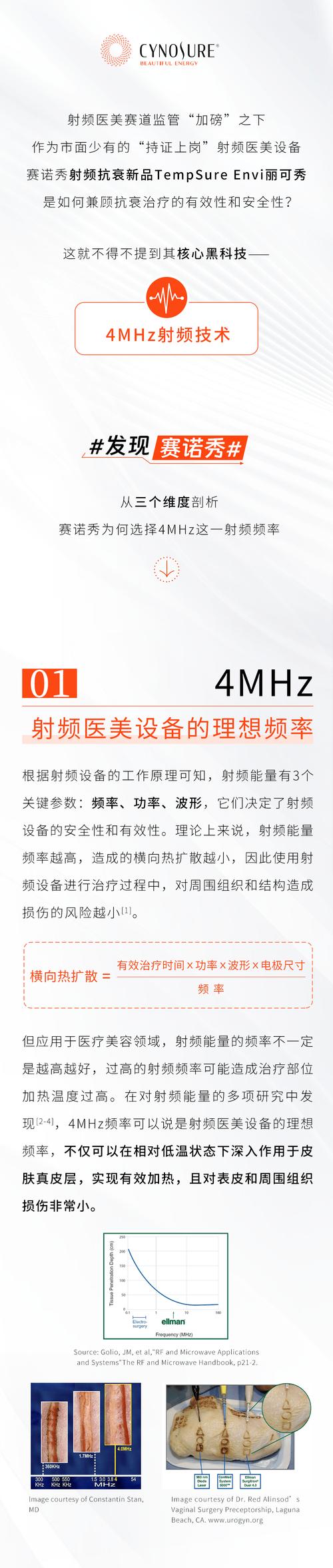 射频技术核心是什么?-图1 射频技术核心是什么?-图1