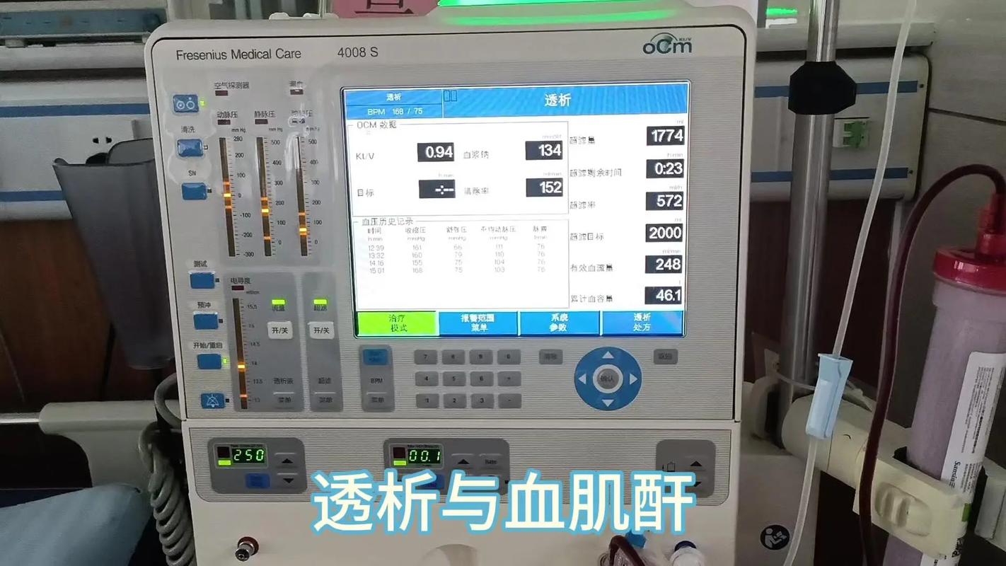 国产血透机品牌价格差异大吗？-图3